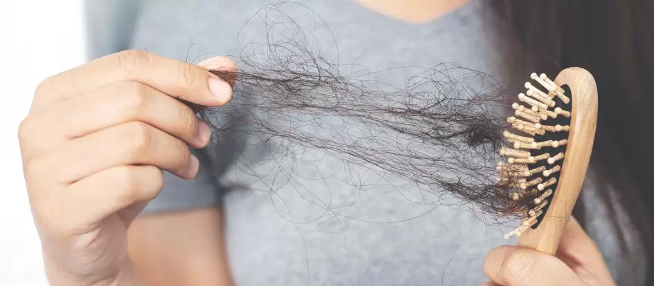 נשירת שיער בקרב נשים - שיער על המסרק